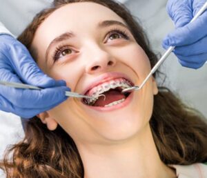 Braces 101