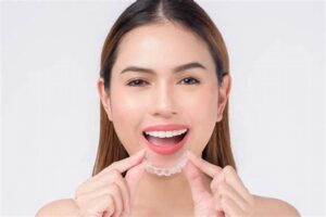 Tip for Invisalign Journey